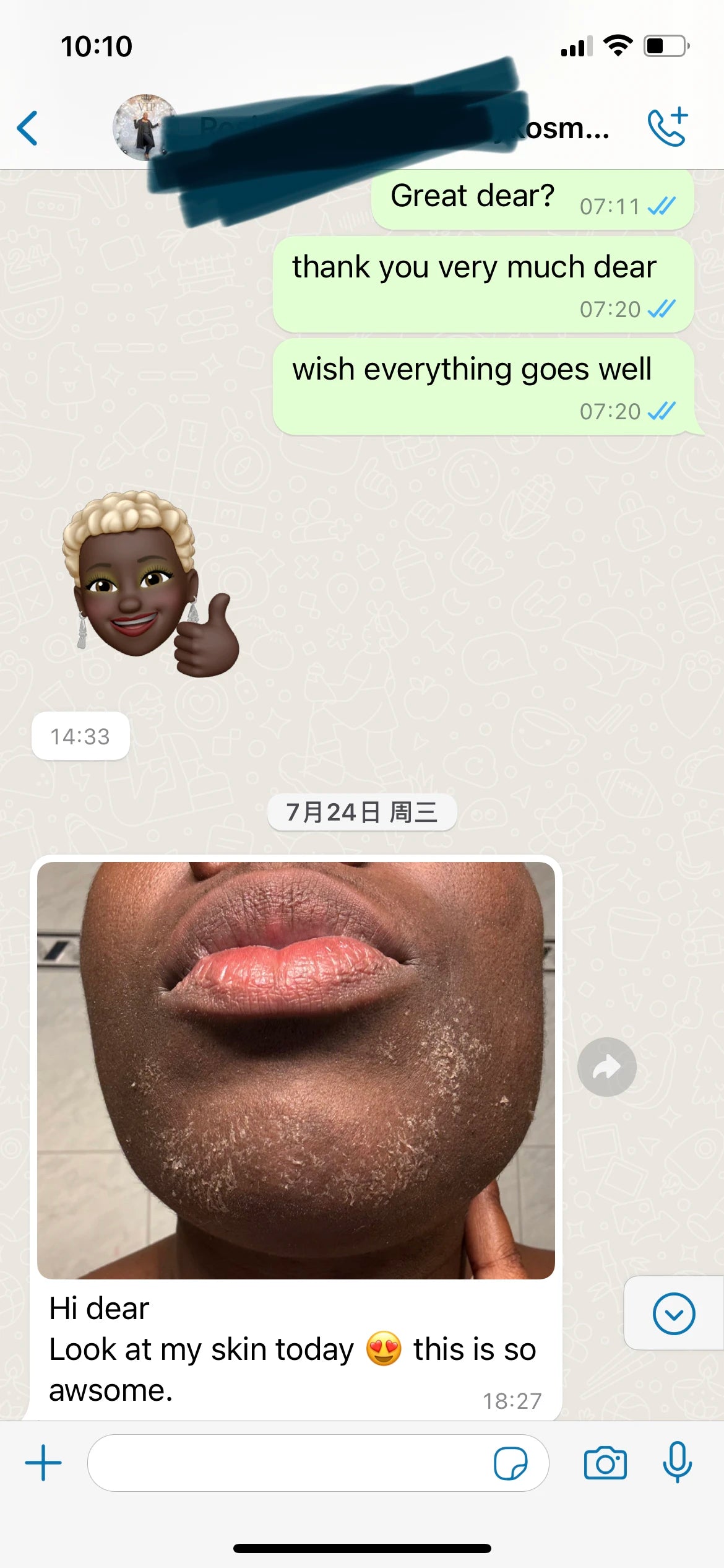 Premium Spongilla Therapy Biomicroneedling Kit - Natural Anti-Acne Acid Free