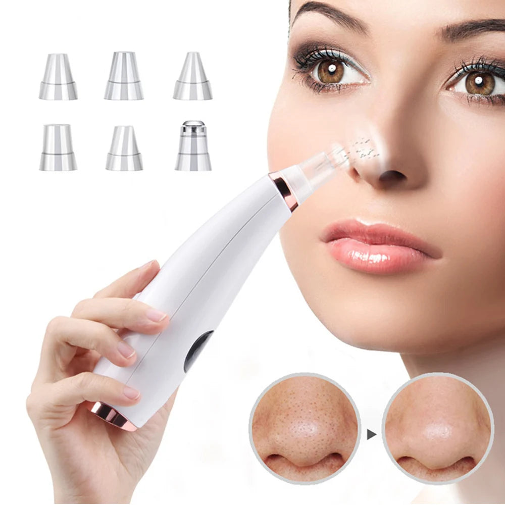 Premium Electric Blackhead Vacuum - Professional Pore Cleaner