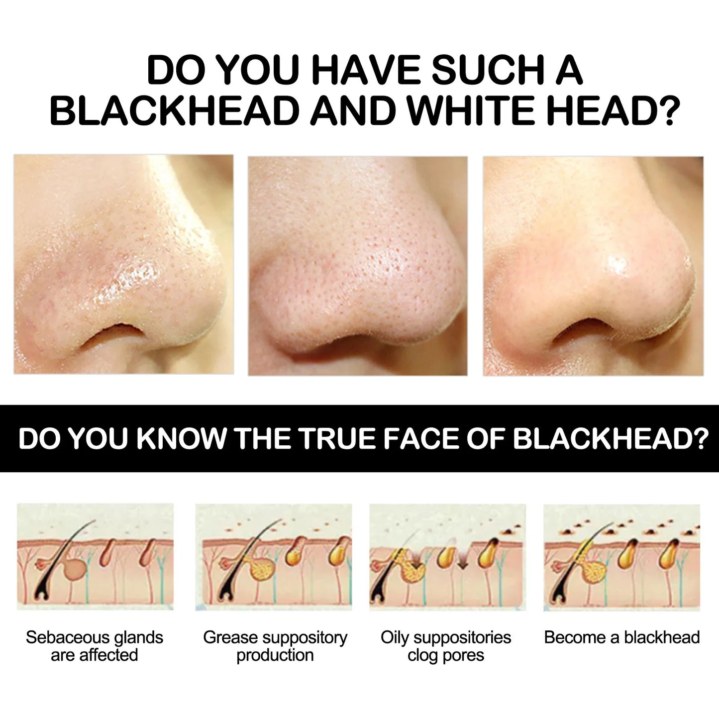 Premium Blackhead Remover Cream - Deep Cleansing Nasal Strips