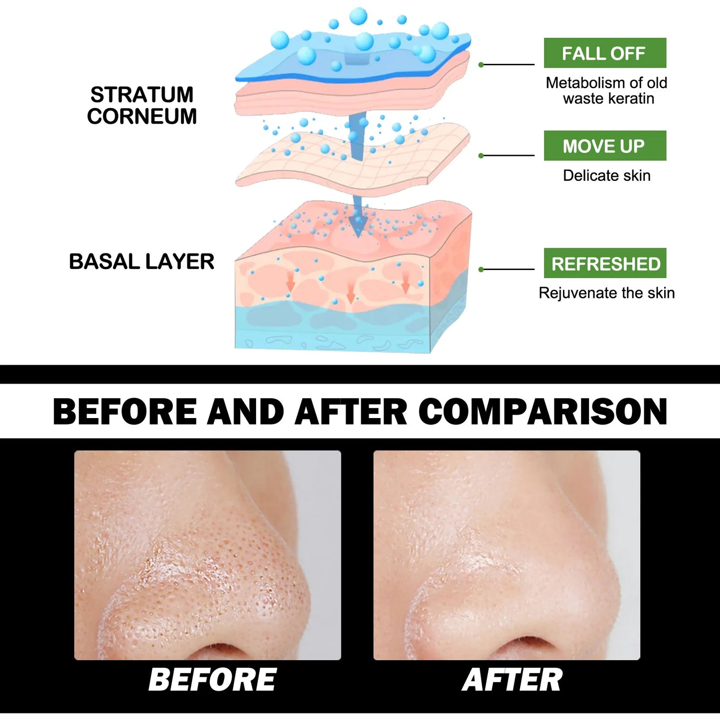 Premium Blackhead Remover Cream - Deep Cleansing Nasal Strips