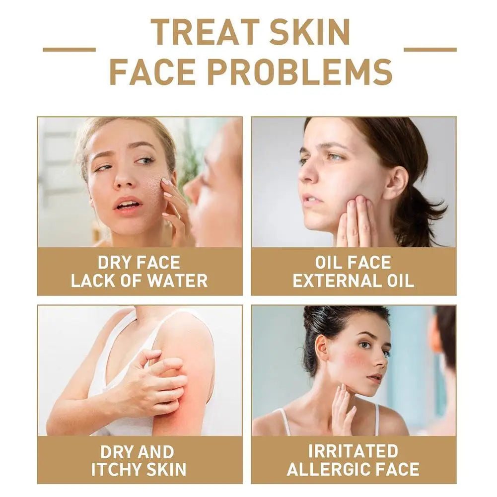 ANUA Niacinamide Riz Toner Hydratant - Réparateur Barrière Cutanée 250ml