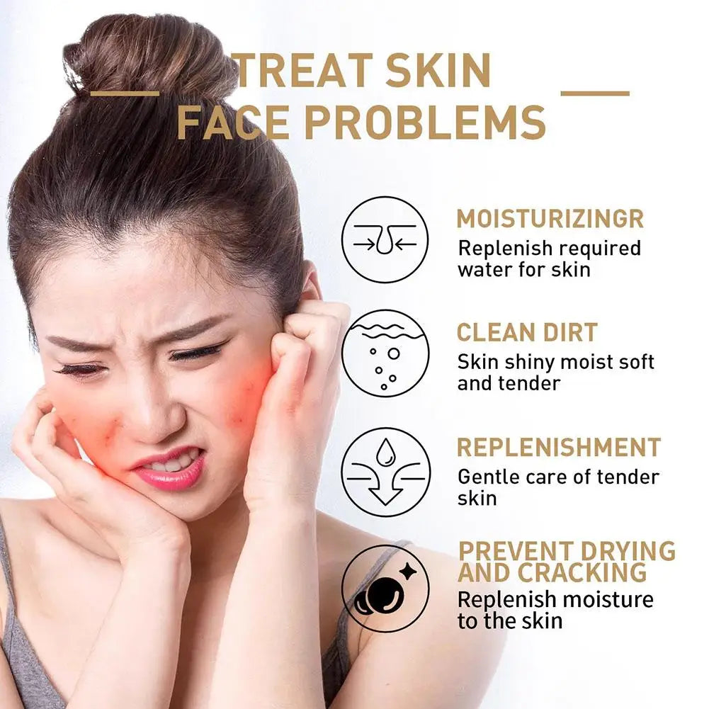 ANUA Niacinamide Riz Toner Hydratant - Réparateur Barrière Cutanée 250ml