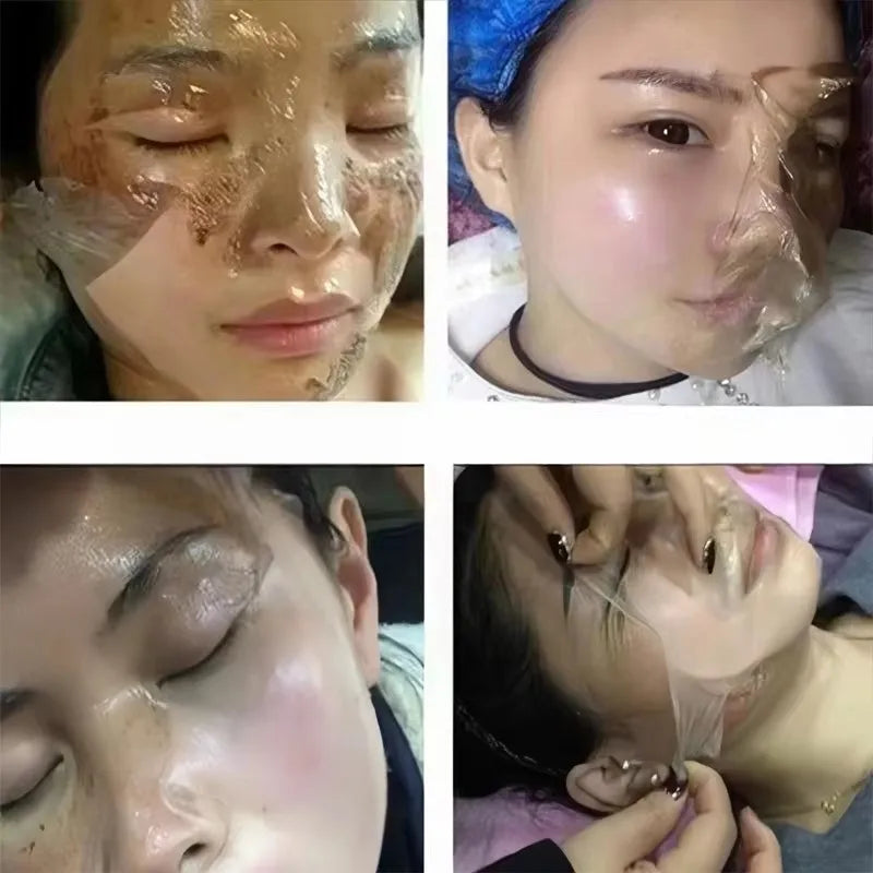 Masque Anti-Taches Visage - Traitement Pigmentation Cicatrices Acné Éclaircissant