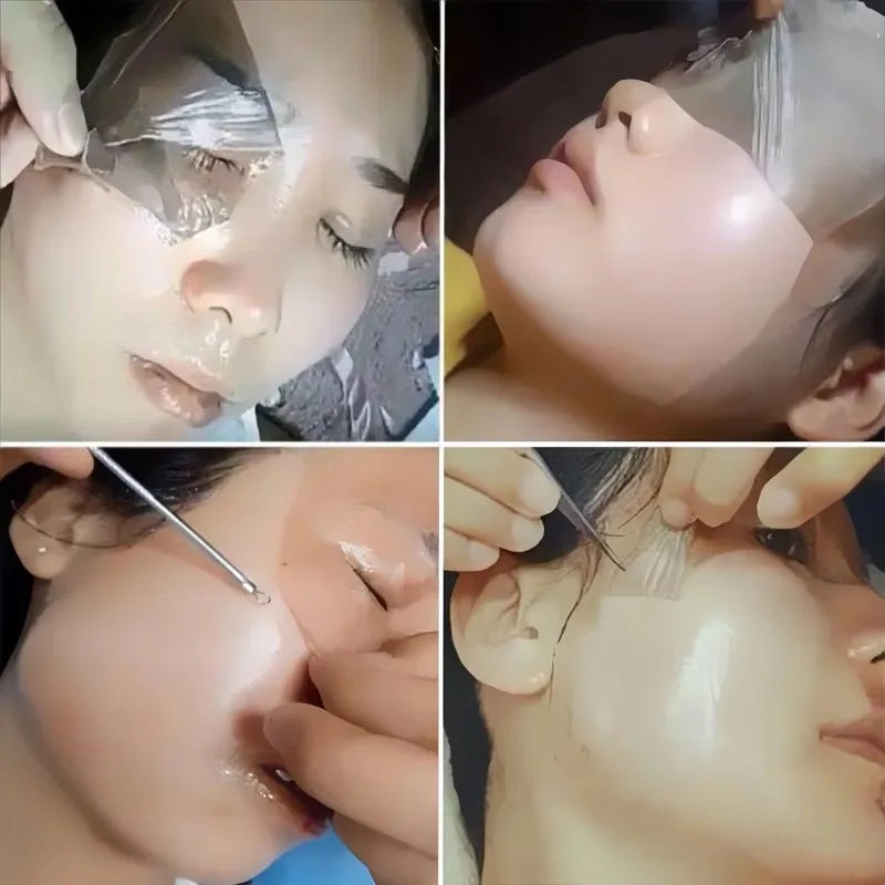 Masque Anti-Taches Visage - Traitement Pigmentation Cicatrices Acné Éclaircissant