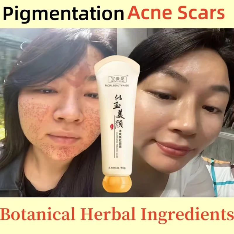 Masque Anti-Taches Visage - Traitement Pigmentation Cicatrices Acné Éclaircissant